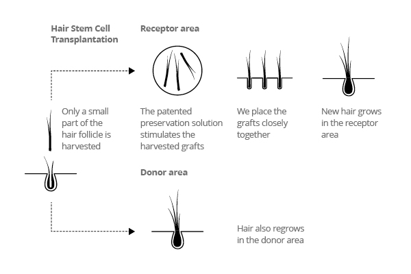 hair stem cell treatment